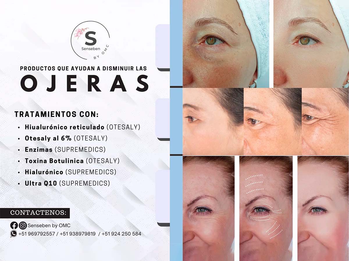 Productos que Ayudan a Disminuir las Ojeras